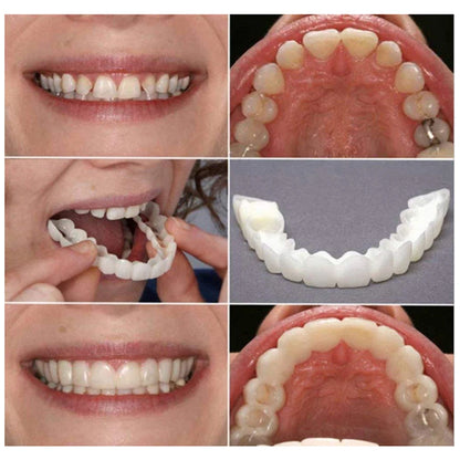 Snap-on Dental Veneers - Perfect Smile